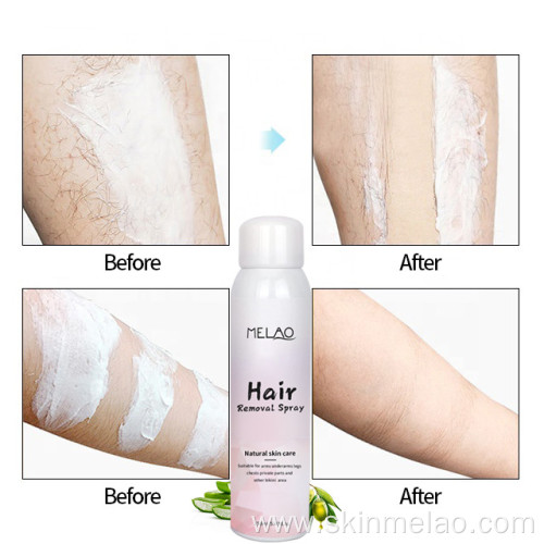 Removal Spray Depilatory Cream Removal Hair Care